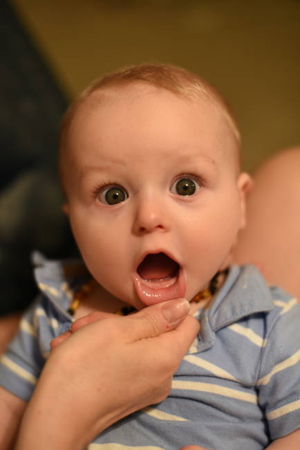 Remy's first teeth
