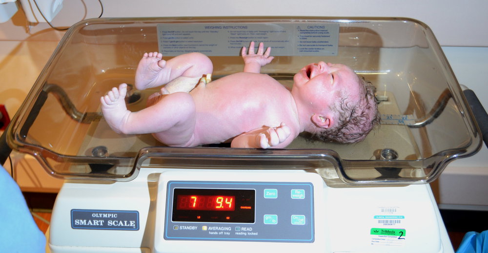 Remy at birth